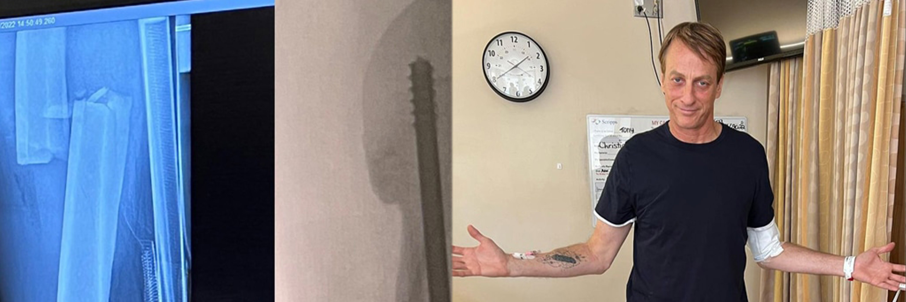 Tony Hawk Faces 'Biggest Test' of Skateboarding Retirement After Breaking His Leg